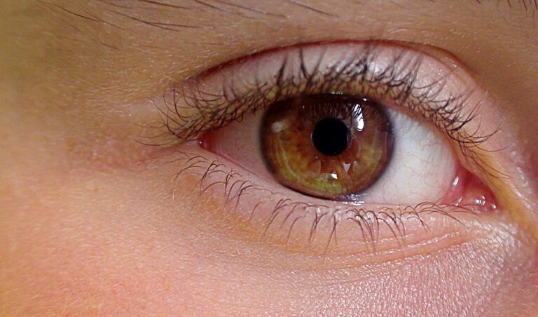 Lidrandentzündung (Blepharitis): Ursachen, Symptome und Behandlung 