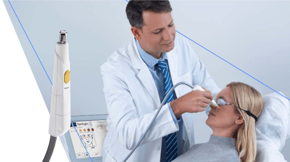 Lumenis OptiLight Behandlung des Trockenen Auges